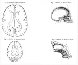 Horizonal sections through "Negro's brain" and "Animal's brain", and cross sections seen from the side of "Negro's skull" and "Animal's skull".