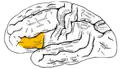 Lateral surface of left cerebral hemisphere, viewed from the side. (shown in orange).
