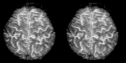 fMRI