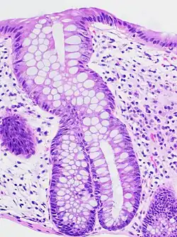 Crypt branching and other architectural distortions