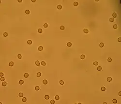 An image taken from a microscope showing a sparse collection of red blood cells