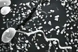 Microsporidian spore (Microsporidia)