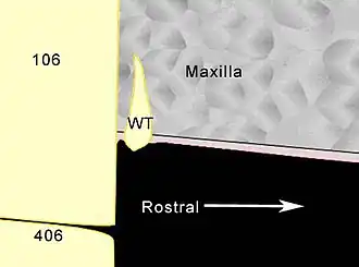 Diagram showing a longitudinal section through a typical wolf tooth.