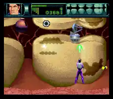 A screenshot from Rex Ronan: Experimental Surgeon.