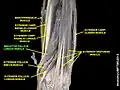 Abductor pollicis longus muscle
