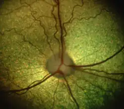 Image 5The dog's retina shows the optic disc and the eye's vasculature. (from Dog anatomy)