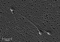 Electron micrograph of human spermatozoa magnified 3140 times.