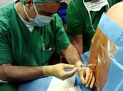 A man injects a clear liquid through a tube into the patient's spine